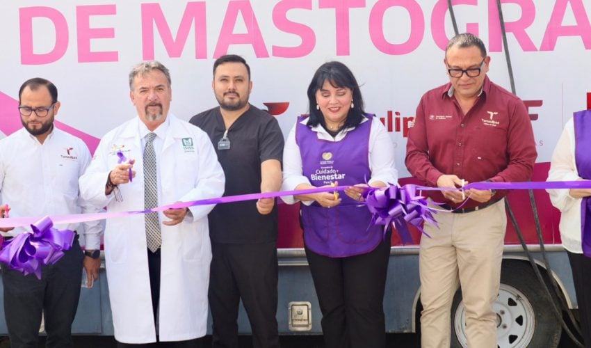 LA COMISION ESTATAL DE ATENCION A VICTIMAS INSTALA MOVIL DE MASTOGRAFIAS